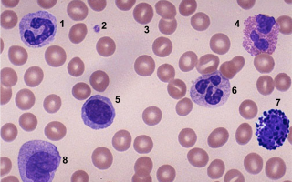 лейкоциты в мазке уретры
